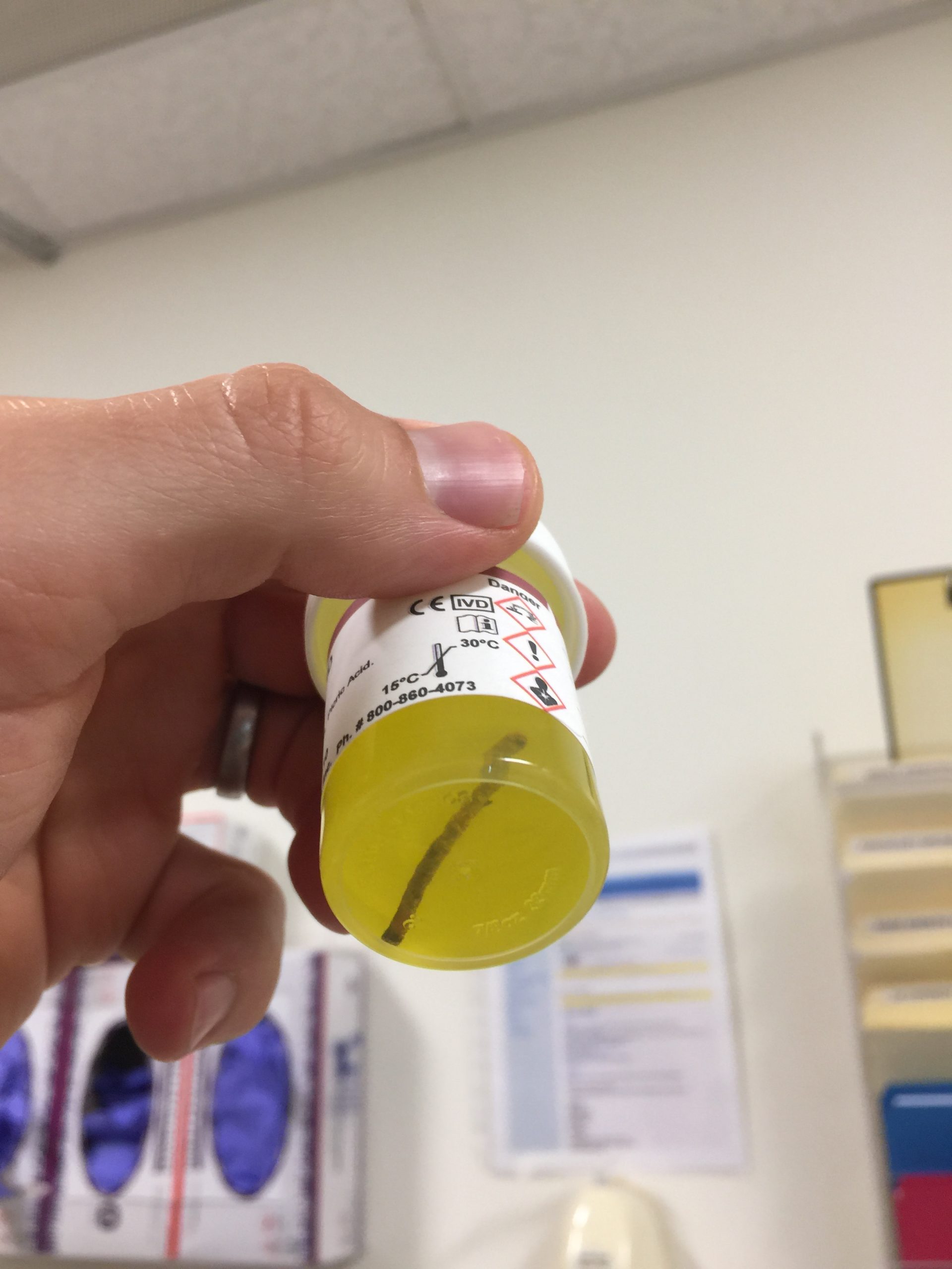 A core of my bone marrow