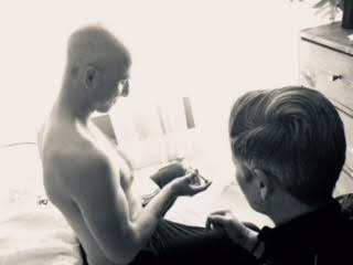 Day 55 self-injection